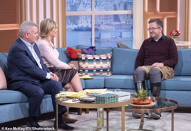 man amputates leg for sick sexual fantasy